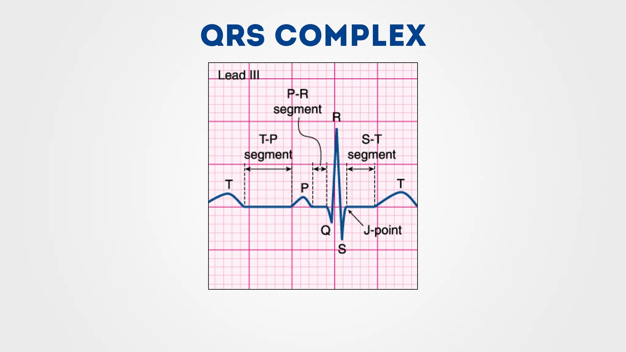 Расшифровка ЭКГ QRS. Комплекс QRS на ЭКГ норма. ЭКГ комплексы расшифровка. Сегмент QRS на ЭКГ. Зубцы экг в норме