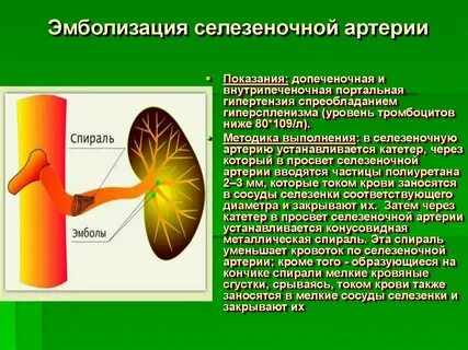 Спираль в сосуде
