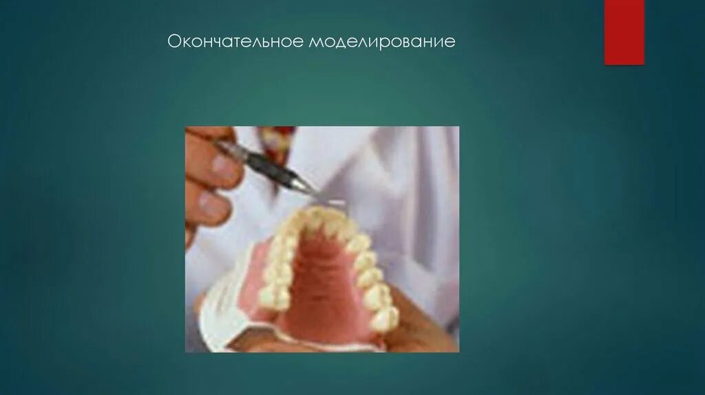 Моделирование базиса. Моделировка базиса нижней челюсти. Окончательное моделирование базиса протеза. Моделировка базиса верхней челюсти. Окончательная моделировка съемного протеза.