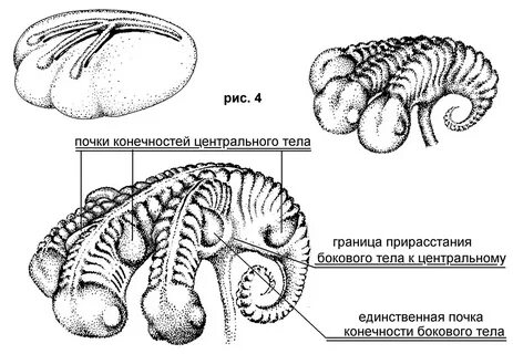 Единственная почка
