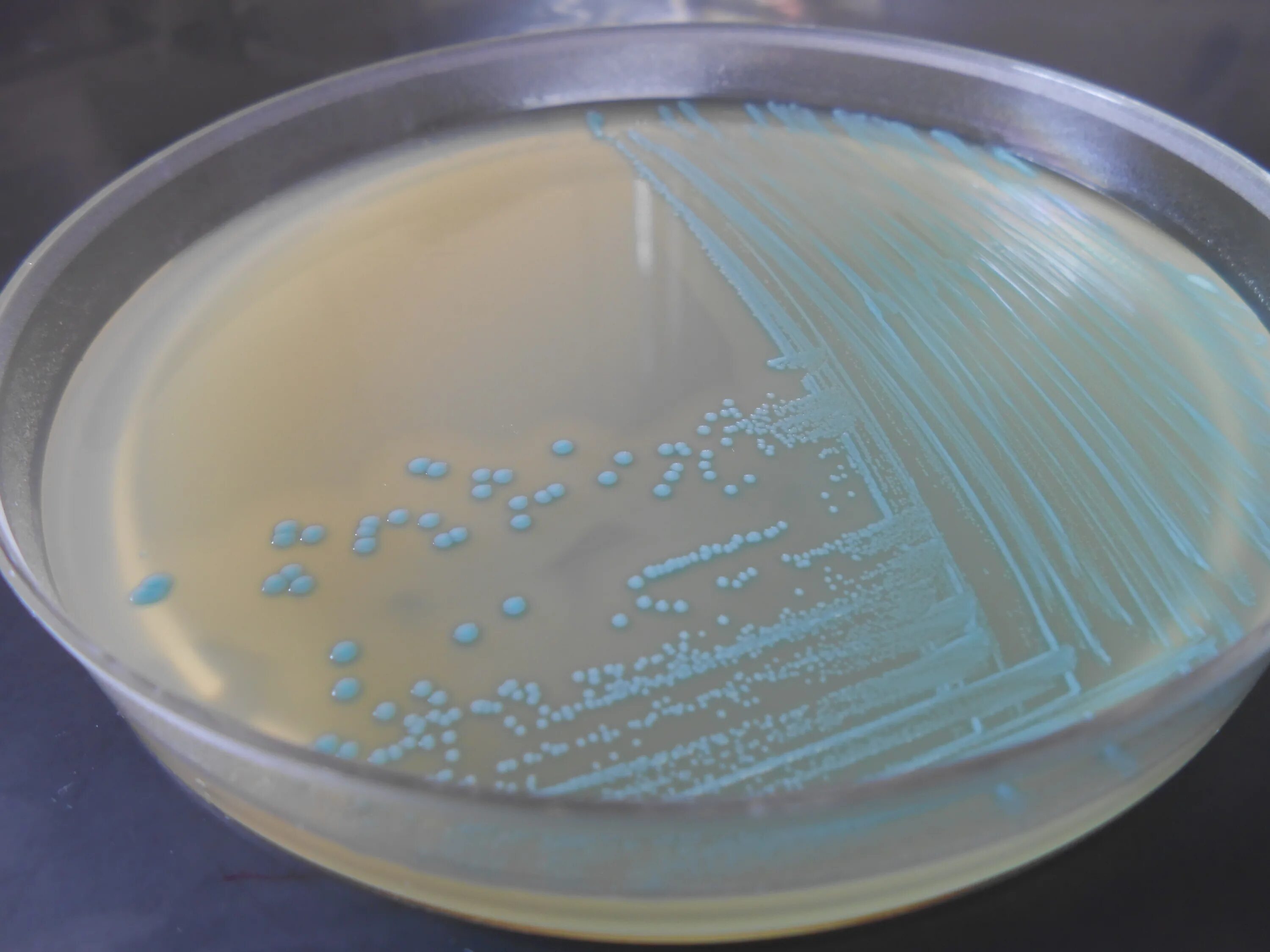 Колонии сальмонелл на мпа. Сальмонелла в воде. Сальмонеллез микробиология. Сальмонелла энтерика. Сальмонеллез и хеликобактер пилори.