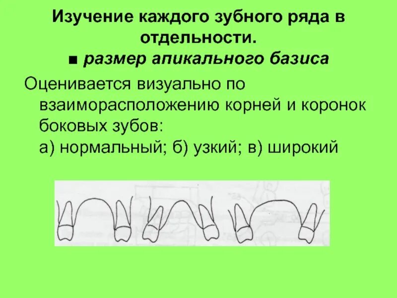 Длина базиса. Апикальный Базис. Ширина апикального базиса. Ширина и длина апикального базиса. Длина базиса верхней челюсти.