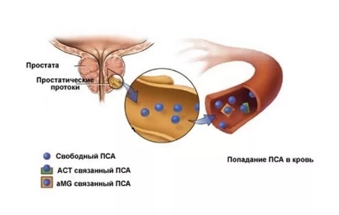 Пса на простату у мужчин