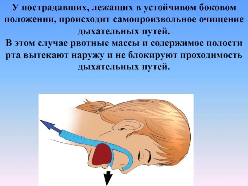 Аспирация в больнице. Аспирация в больнице