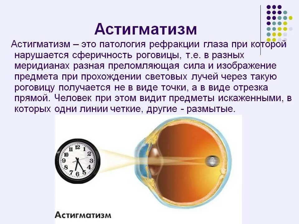 Гдазое заболевание асемаиизм. Болезнь глаз астигматизм. Сложный гиперметропический астигматизм. Астигматизм 2.5 диоптрии. Почему при боковом зрении хорошо видна