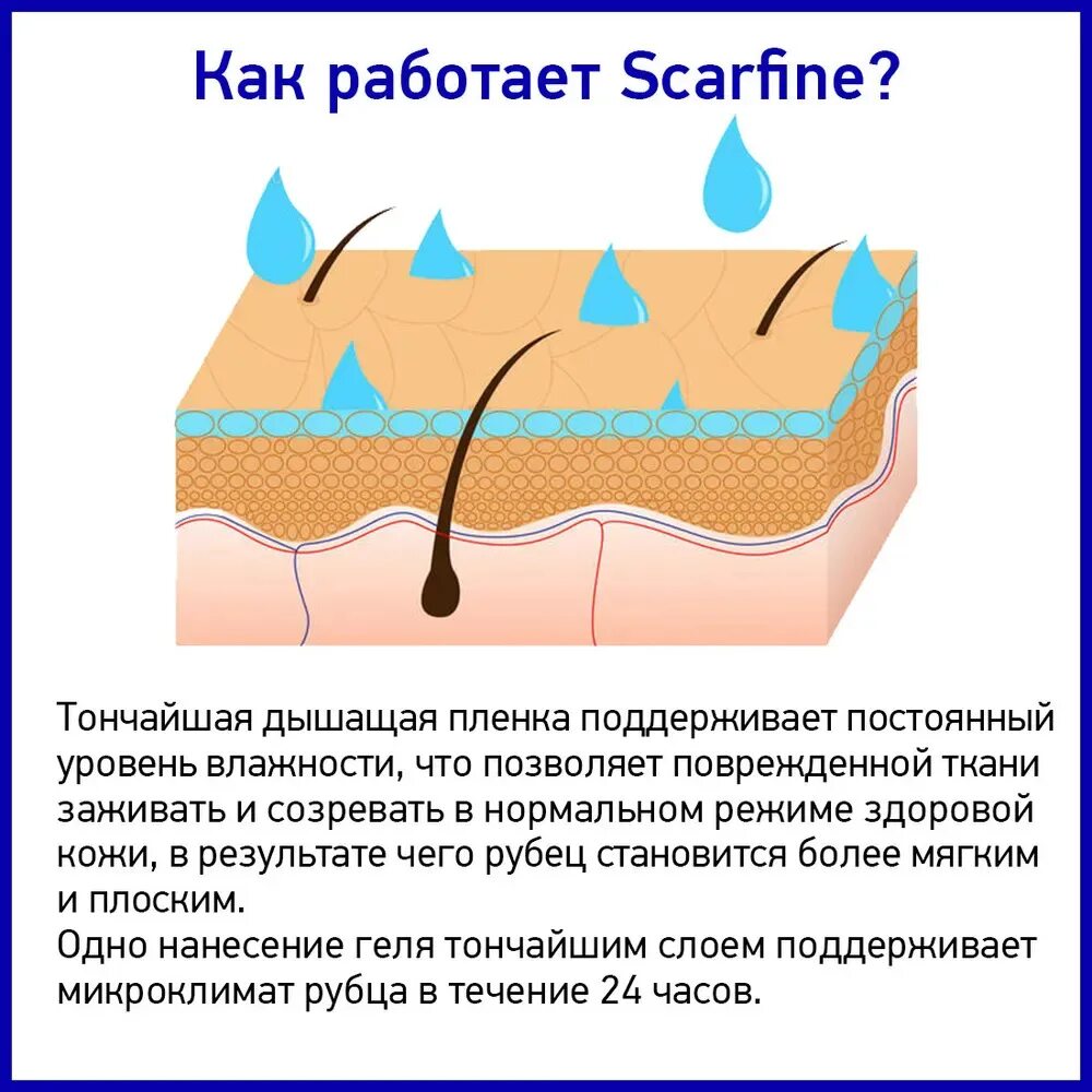 Освобождение от рубцов латынь. Scarfine гель от рубцов. Гель от постакне и рубцов. Мазь гель от шрамов и рубцов.