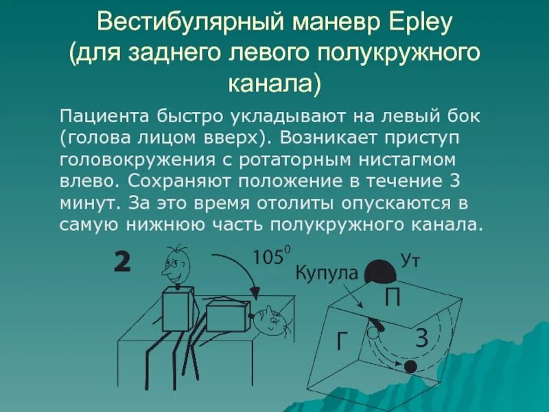 Маневр при головокружении. Позиционное головокружение маневр эпли. позиционные маневры при головокружении. вестибулярная гимнастика маневр эпли. маневр эпли при головокружении.