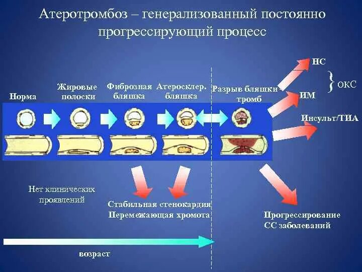 Генерализованный процесс это. Атеротромбоз симптомы. Процессы атеротромбоза. Атеротромбоз патогенез.