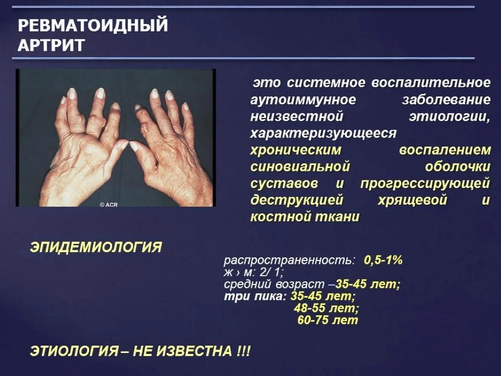 Диагноз доа суставов. Ревматоидный артрит поражение суставов. Симптомы поражения суставов ревматоидного артрита. Паллиативный ревматоидный артрит. Хронический ревматоидный артрит диагноз.