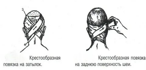Повязка на затылок