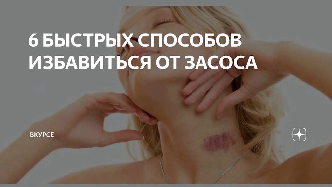 Можно быстро избавиться от. Быстрое избавление от засоса. как можно быстро убрать засос. как быстро избавиться от засоса.