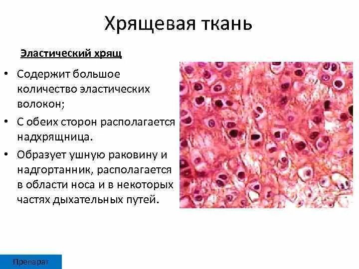 Суставный хрящ какая ткань. Эластический хрящ гистология. Эластический хрящ ( эластическая хрящевая ткань). Соединительная ткань эластический хрящ. Эластическая хрящевая ткань надхрящница.