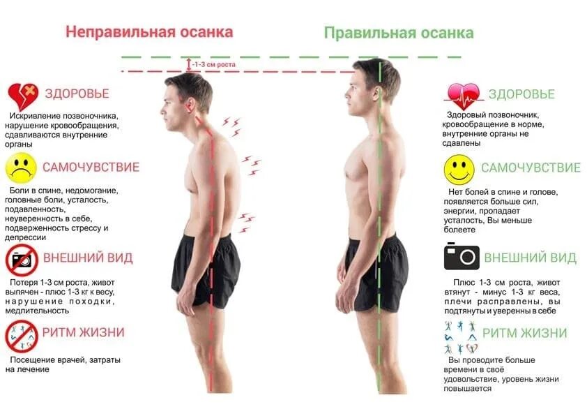Как исправить осанку у взрослого