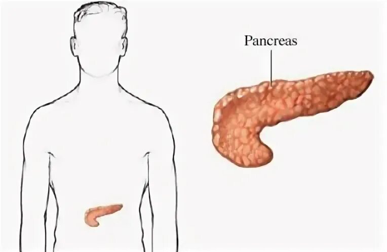 Панкреатит и язва желудка. Поджелудочная железа человека. Поджелудочная железа человека без подписей. Паразиты в поджелудочной железе. Искривление поджелудочной железы у ребенка.