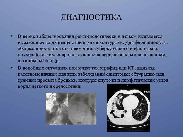 Диагноз легкое расстройство. Диагностика при гнойных заболеваниях легких. Гнойные заболевания легких симптомы. Лечение гнойно деструктивных заболеваний легких.