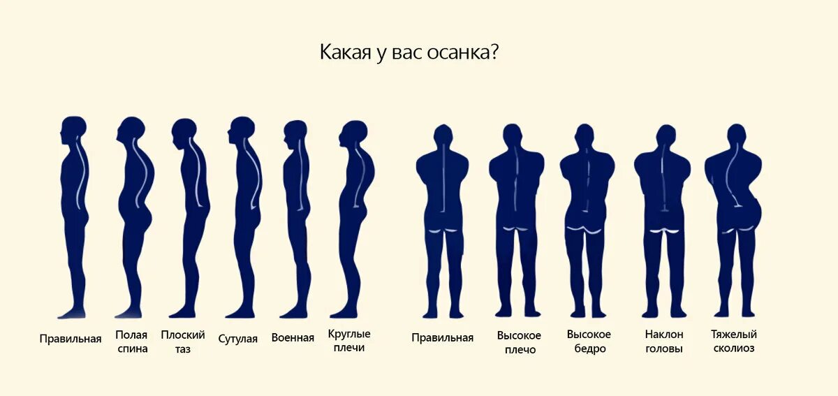 Осанка. Правильная осанка. Нормальная осанка мужчины. Естественная осанка. Straight back