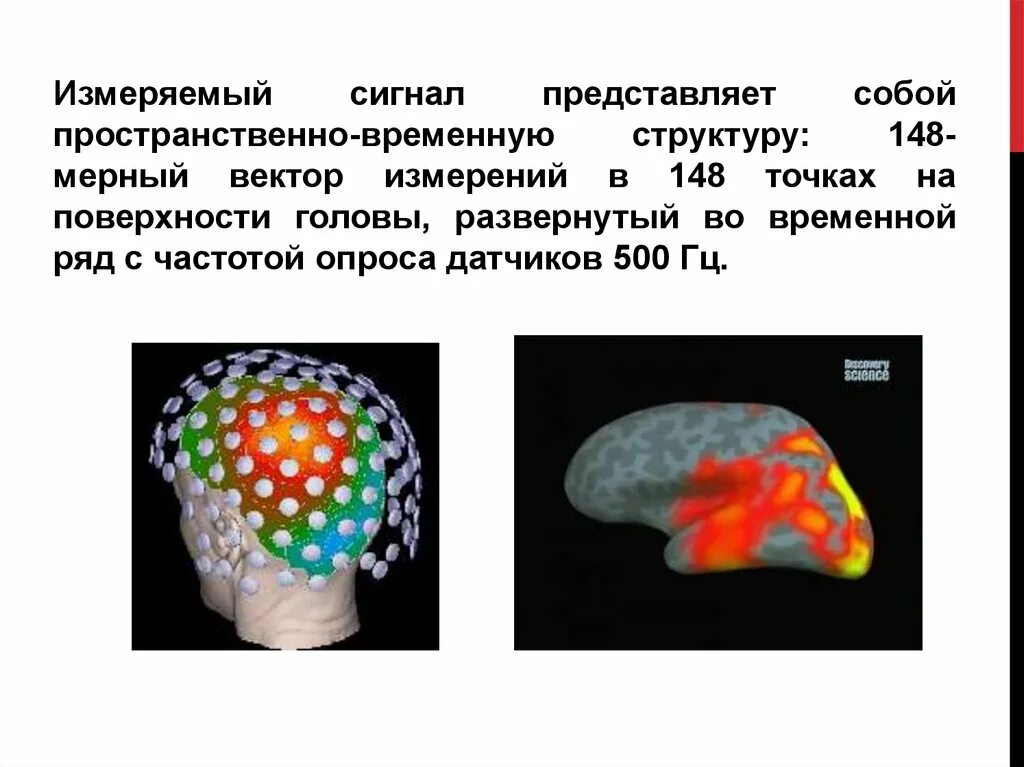 Пространственно временной сигнал. Пространственно -временные сигналы. анализ поверхности головы. магнитоэнцефалография. представляет собой временную структуру.