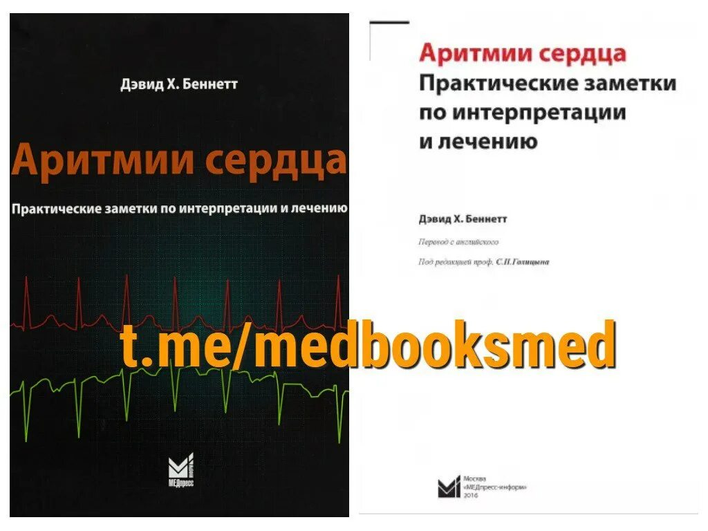 Нарушения ритма сердца тесты с ответами. Аритмии книга. аритмии сердца беннет. книга «аритмия сердца» белялов. аритмия лечение книга.