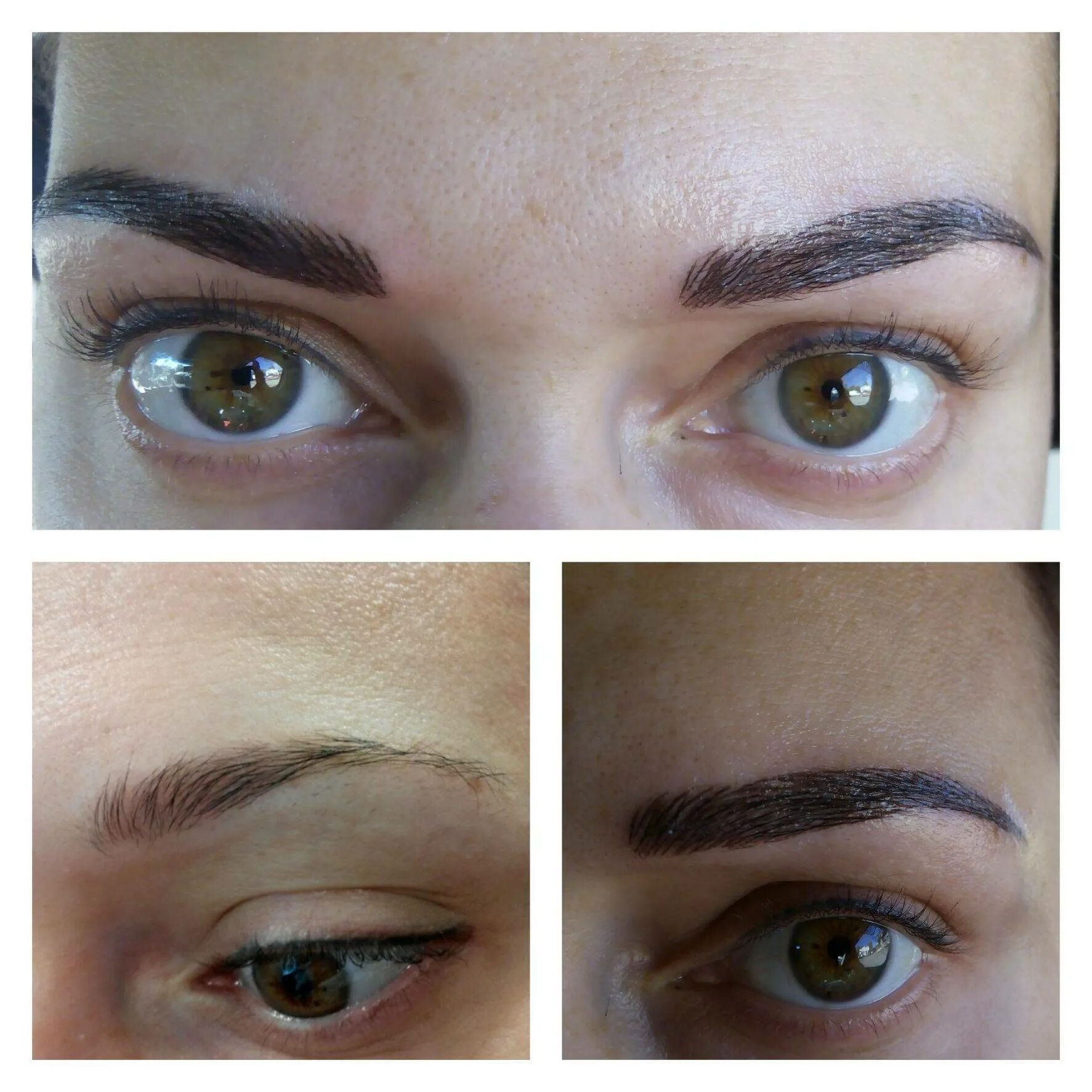 Microblading nightmare left me with weeping blisters and raw skin The Sun