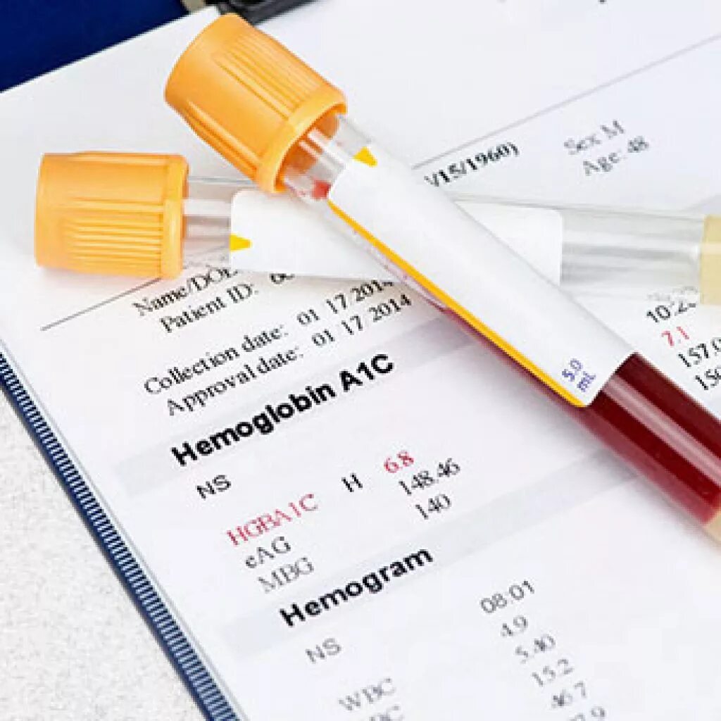 Гликированный гемоглобин (hba1c). Пробирки для гликированного гемоглобина. Гемоглобин a1c норма. Hba1c (гликированный HB) 4.9.