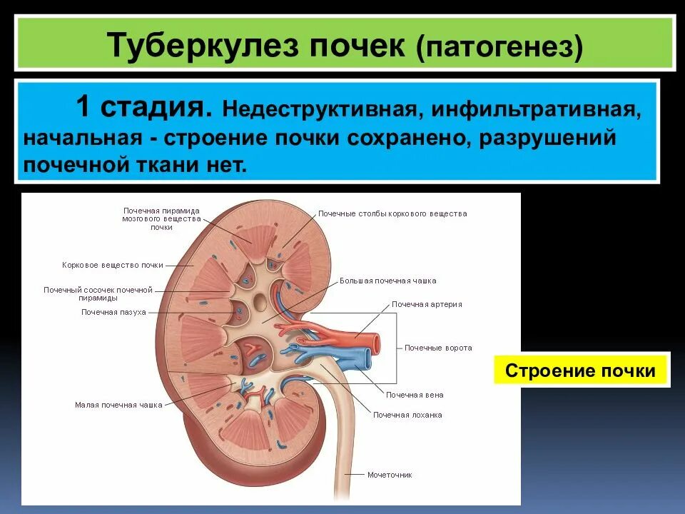 Туберкулез паренхимы почек. Туберкулез паренхимы почек рентген. Туберкулез почек патогенез. Этиология туберкулеза почек. Патогенез почки