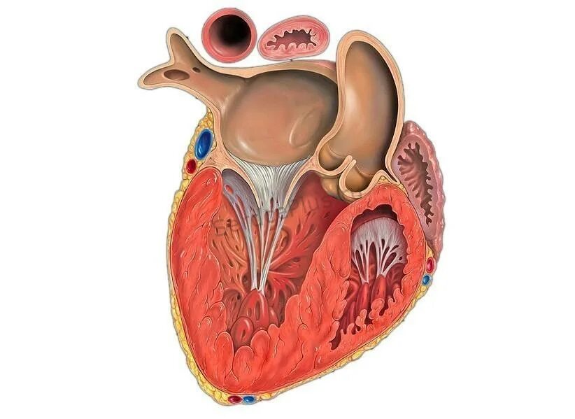 Миокард правого предсердия. Гипертрофия миокарда сердца. Гипертрофия миокардит. Сердце в разрезе.