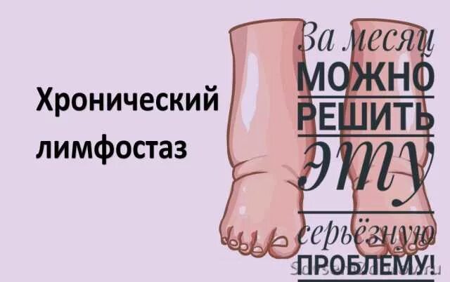 Как выглядит лимфостаз руки Упражнения для послеоперационного лимфостаз руки. Малиновская YouTube