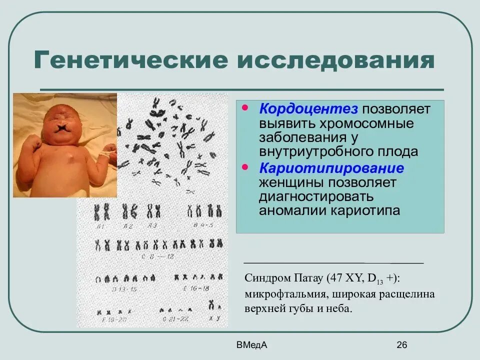 Исследование ребенка кариотипа плода. Методы исследования синдрома Патау. Патологии кариотипа. Хромосомные отклонения. Наличие лишней хромосомы