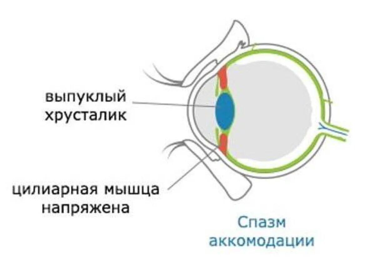 Спазм аккомодации при гиперметропии. Аккомодационная мышца глаза. Цилиарных мышц. Цилиарная мышца глаза. Причины аккомодации