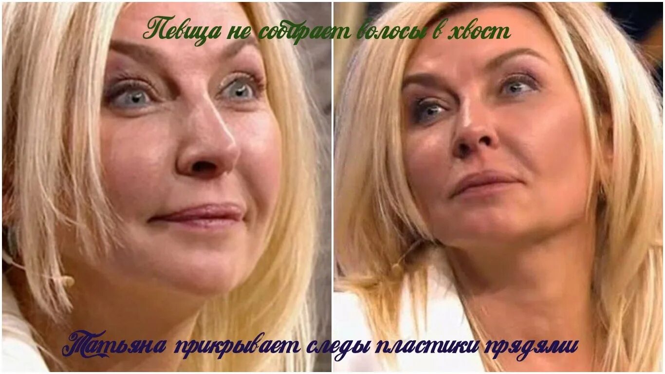 Татьяна Овсиенко- пластические операции, биография и личная жизнь