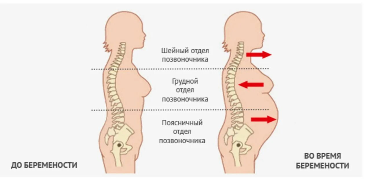 Боли в спине после тяжести. Изменения позвоночника. Позвоночник при беременности. Изменения позвоночника у беременных. Осанка в беременность.