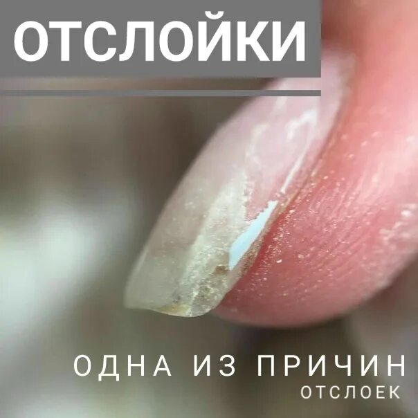 Почему отслойка на свободном крае. Отслойки гель лака. отслойка гель лака от ногтя.