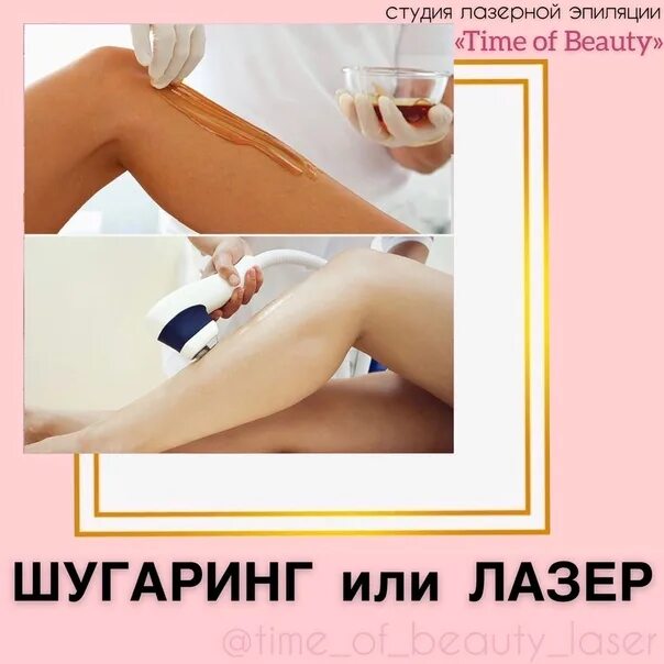 Чем отличается эпиляция от депиляции. Шугаринг или лазерная эпиляция. преимущества лазера перед шугарингом. преимущества шугаринга перед лазерной эпиляцией. преимущества ваксинга перед шугарингом.