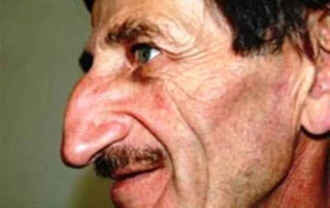 Нос под углом