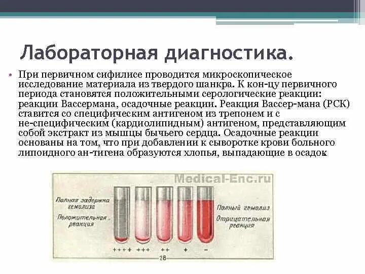 Лабораторная диагностика сифилиса реакция Вассермана. Лабораторная диагностика сифилиса РСК. Реакция Вассермана серологическое исследование. Реакция Вассермана ложноположительный результат.