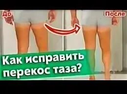 Смещен таз. Смещен таз