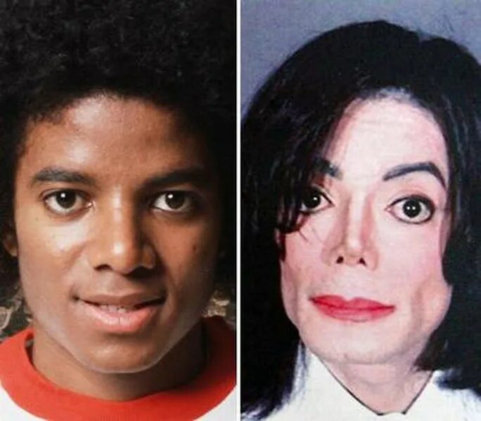 Джексон после операции. Джексон после операции. Джексон после операции. Джексон после операции. Джексон после операции.