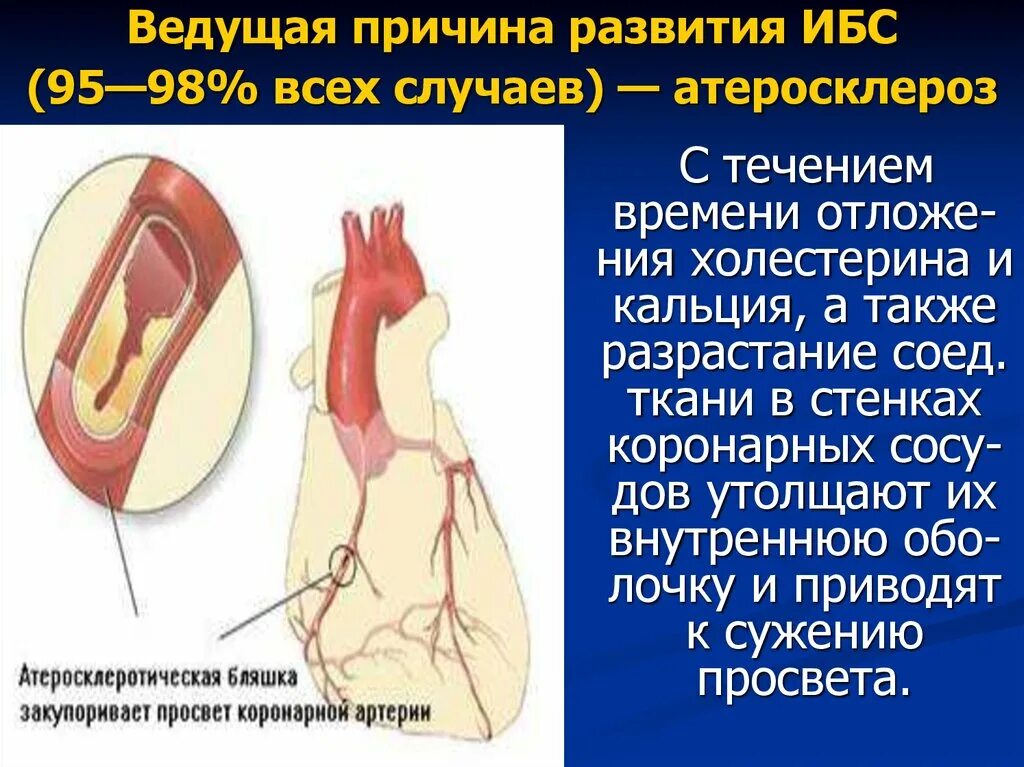 Ишемия передней стенки. ИБС атеросклеротическая болезнь сердца. Факторы развития атеросклероза. Развитию атеросклероза и ИБС способствуют.