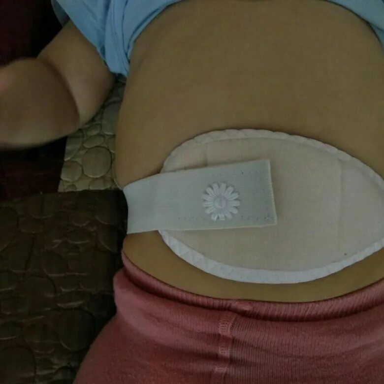 пупок заклеили пластырем