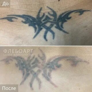 Первый день после тату