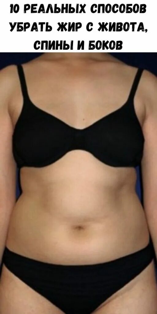 Висцеральный жир у женщин. Типы отложения жира у женщин. Виды жира на животе и причины. Локальные жировые отложения. Типы жировых отложений на животе.