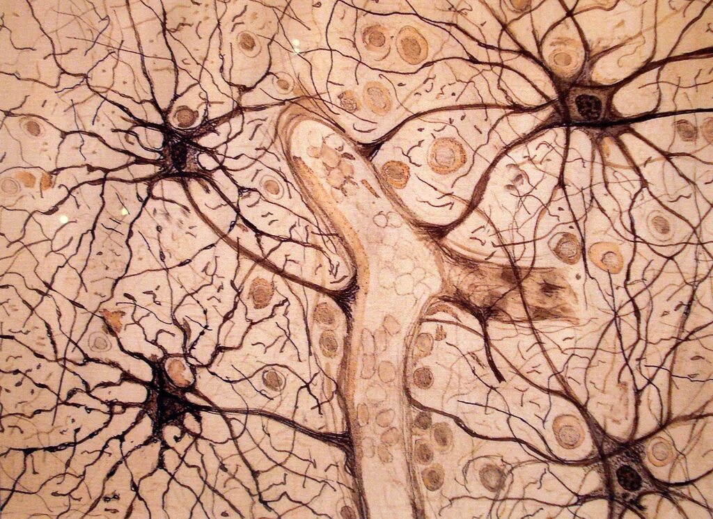 Астроциты головного мозга. Клетки головного мозга астроциты. Нервная ткань микрофотография. Нервная ткань астроциты. Умершие клетки мозга