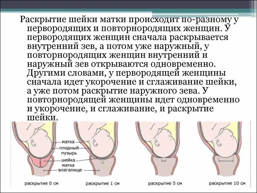 Раскрытие шейной матки. Раскрытие шейки у повторнородящих. Раскрытие шейки матки у первородящих. Раскрытие шейки у первородящих и повторнородящих.