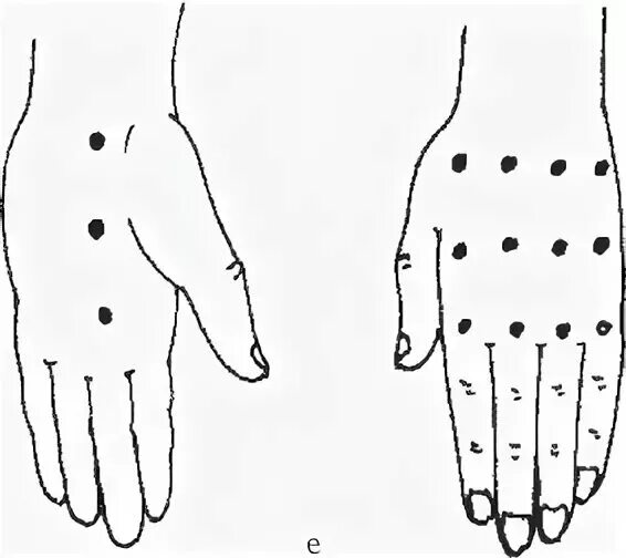 Шиацу массаж точки рук. Шиацу точки на руке. Японский точечный массаж шиацу. Точечный массаж рук. Точки на руках для массажа
