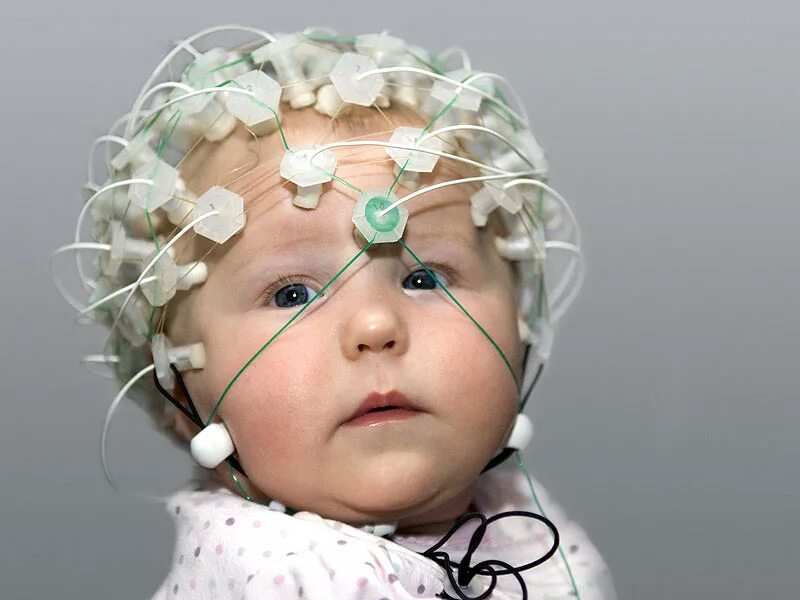 Исследование головы ребенка. Ээг рэг эхо эг. Исследование головы ребенка. Нсг (нейросонография) новорожденного. Электроэнцефалография (ээг).