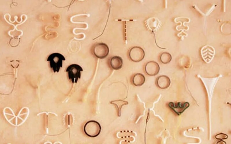 Спираль мирена внутриматочная. Внутриматочная спираль методы контрацептивов. Внутриматочная контрацепция (вмк). Введение внутриматочной спирали алгоритм. Спираль мирена внутриматочная.