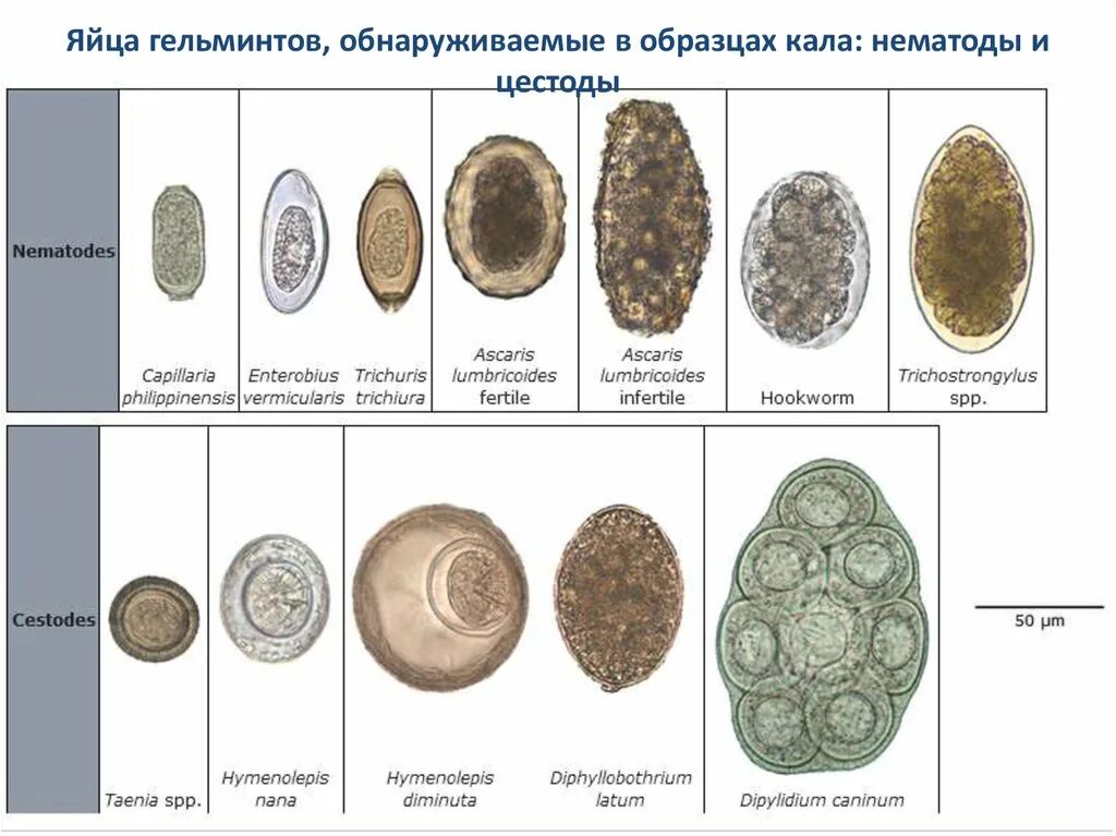 Яйца гельминтов микроскопия. Яйца гельминтов паразитов человека. Яйца яйцеглист глистов. Яйца ленточных червей в Кале. Купить яйца глист