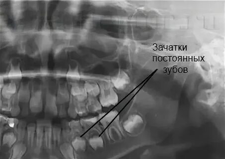 Зачатки способности