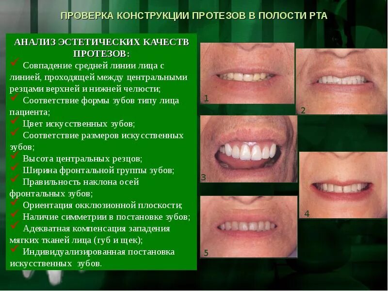 Линии рта были. Центральное соотношение челюстей. смещение средней линии челюсти. ошибки определения центральной окклюзии. смещение центрального соотношения челюстей.