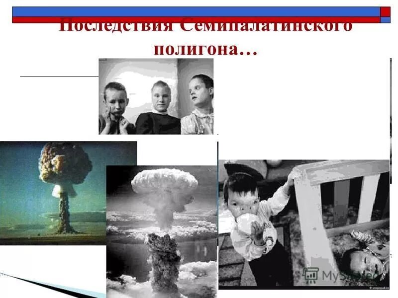 Жертвы полигона. Жертвы полигона. Семипалатинский ядерный полигон люди. Семипалатинский полигон последствия ядерных испытаний. Семипалатинск 1949.